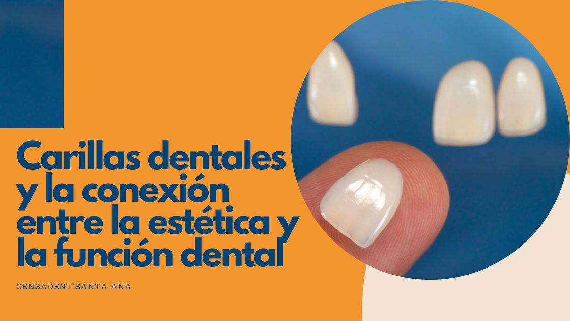 Carillas dentales y la conexión entre la estética y la función dental