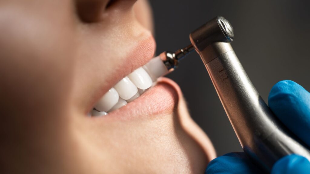 limpieza dental