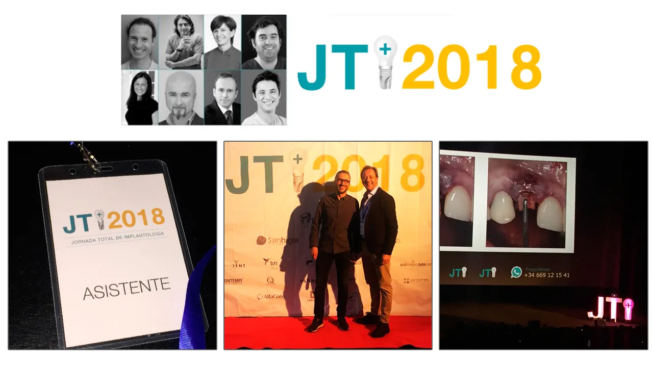 ASISTIMOS A LA JTI2018, EL EVENTO MÁS REVOLUCIONARIO DE LA IMPLANTOLOGÍA.