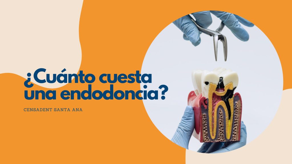 cuanto cuesta una endodoncia