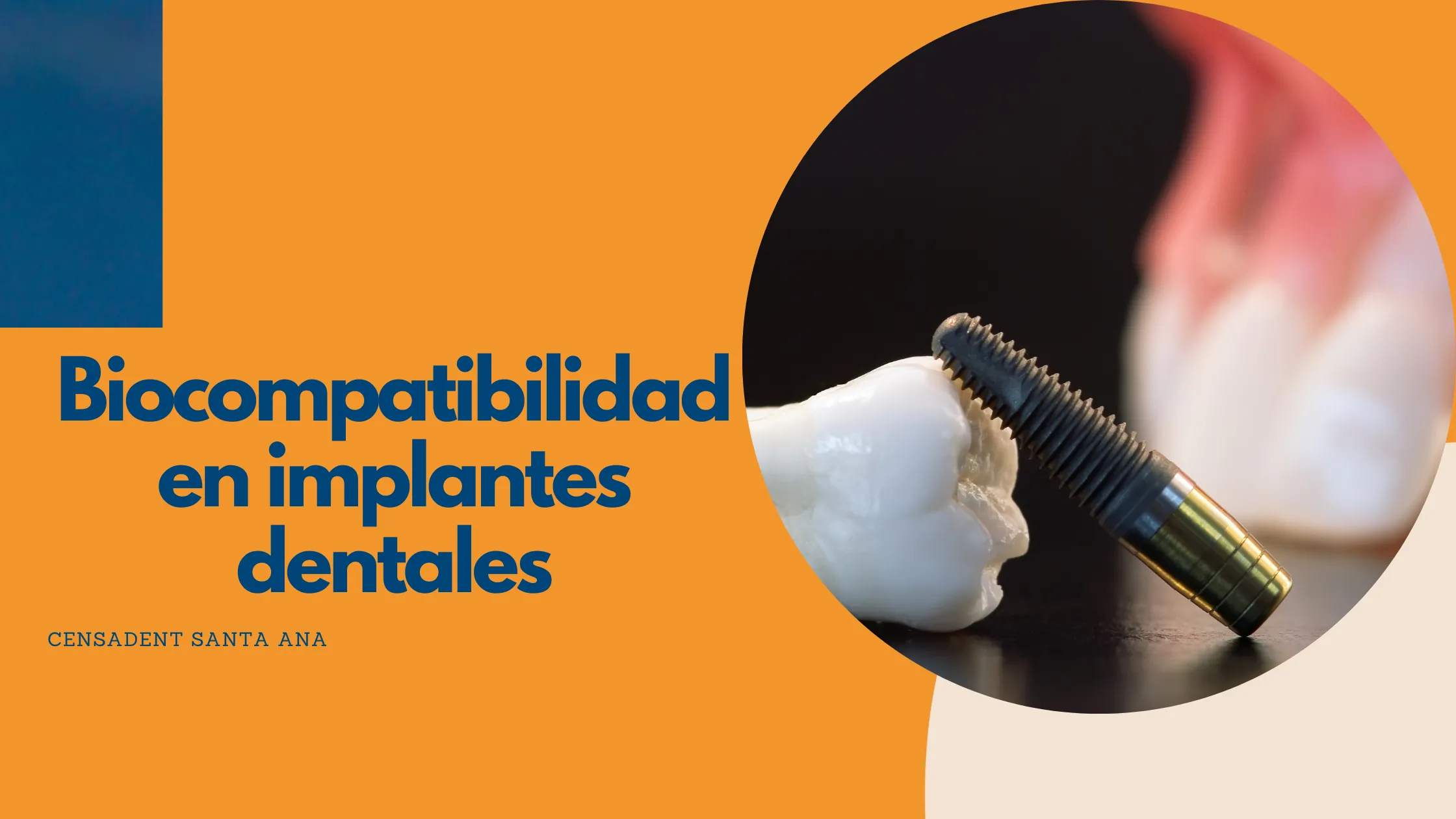Biocompatibilidad en implantes dentales: ¿Por qué es crucial para tu salud?