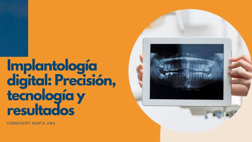 Implantología digital Precisión, tecnología y resultados en una sola intervención