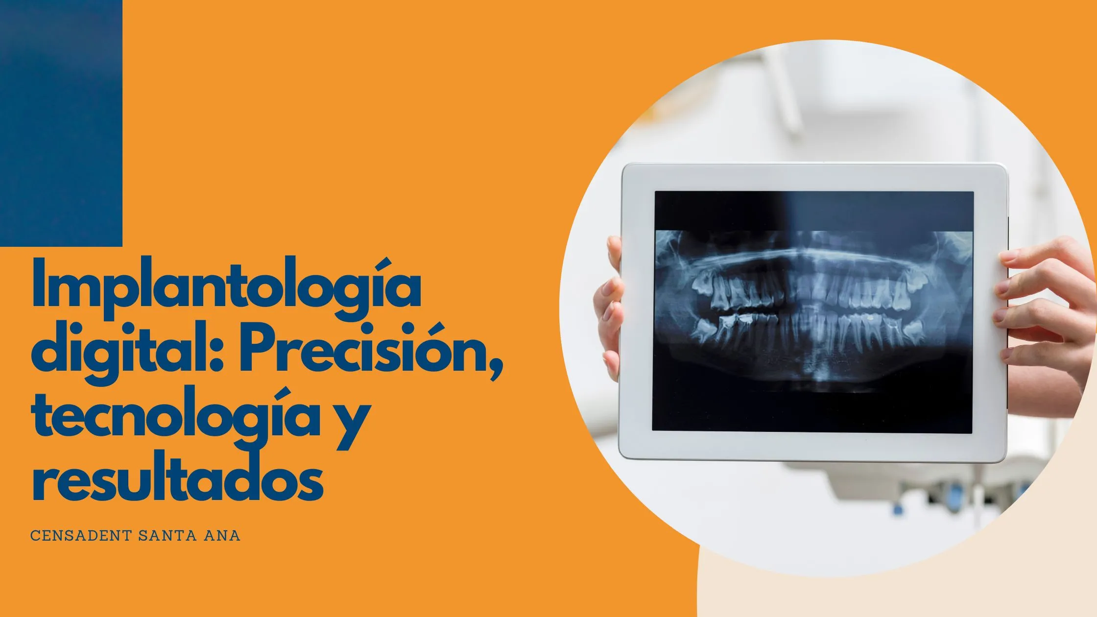 Implantología digital: Precisión, tecnología y resultados en una sola intervención