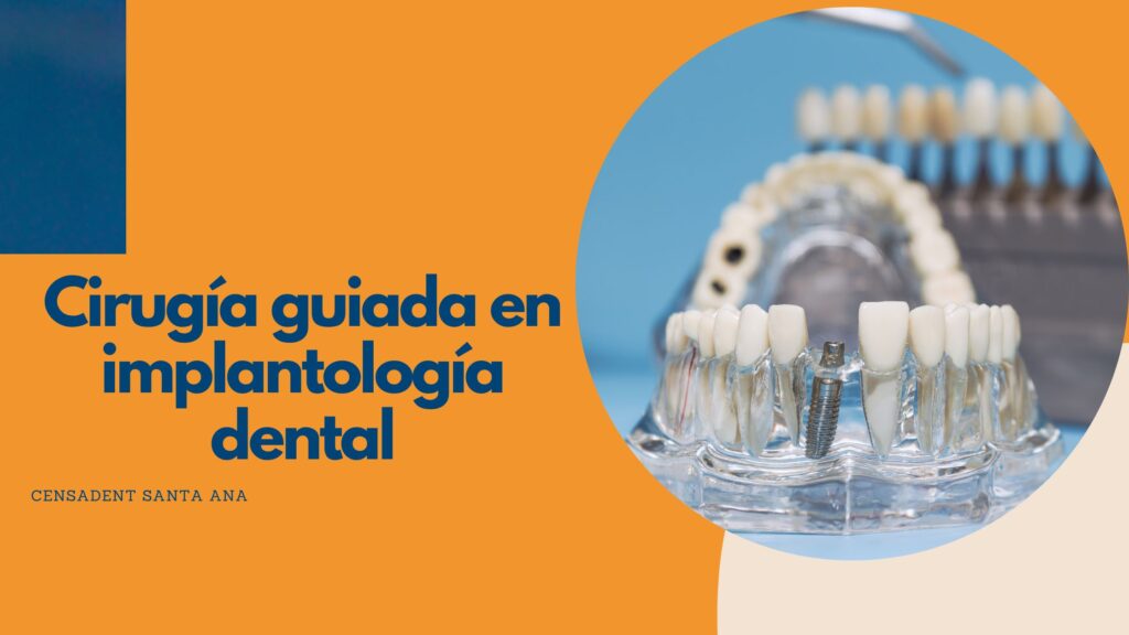 cirugía guiada en implantología dental