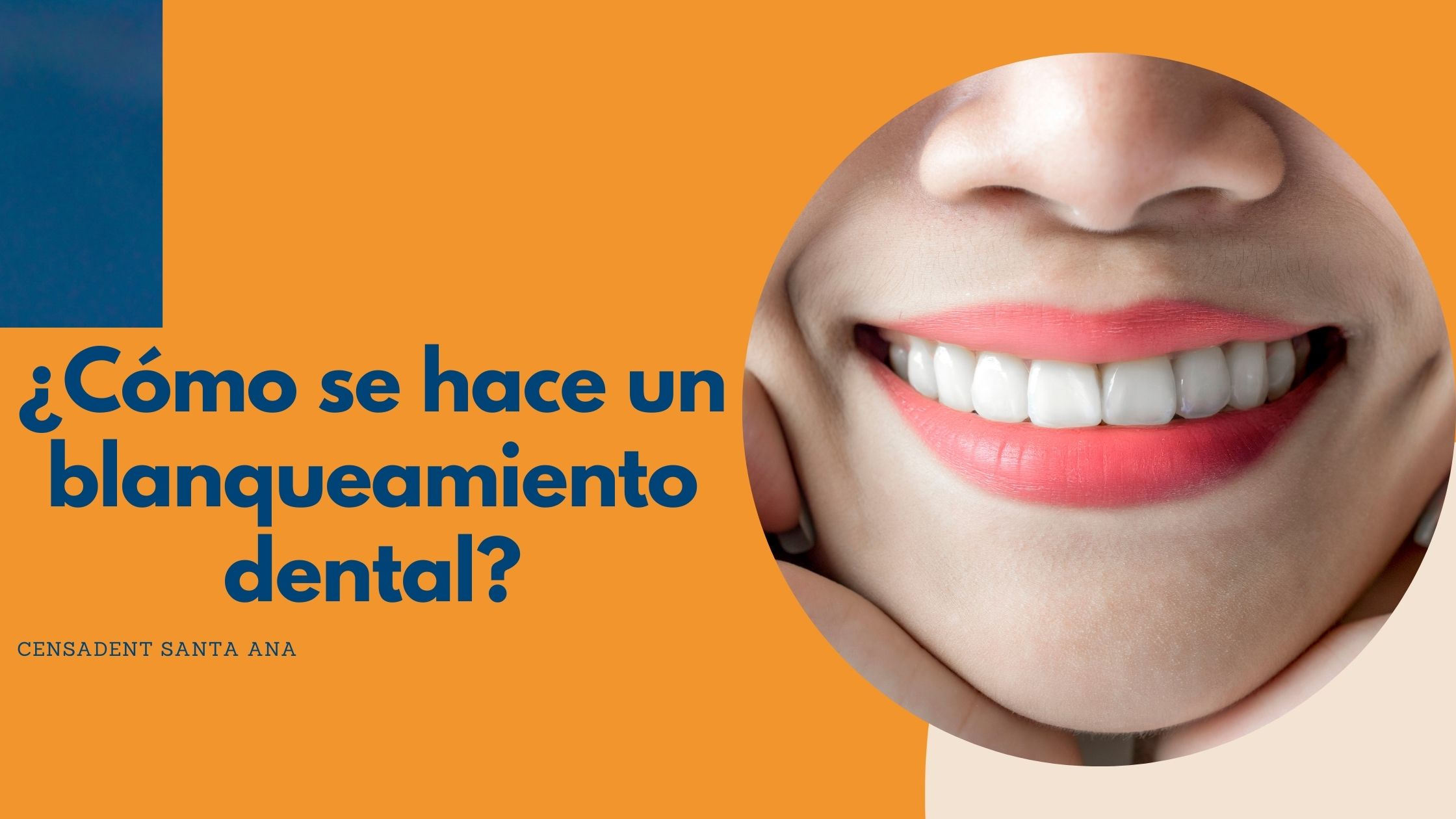 Cómo se hace un blanqueamiento dental: El paso a paso en nuestra clínica