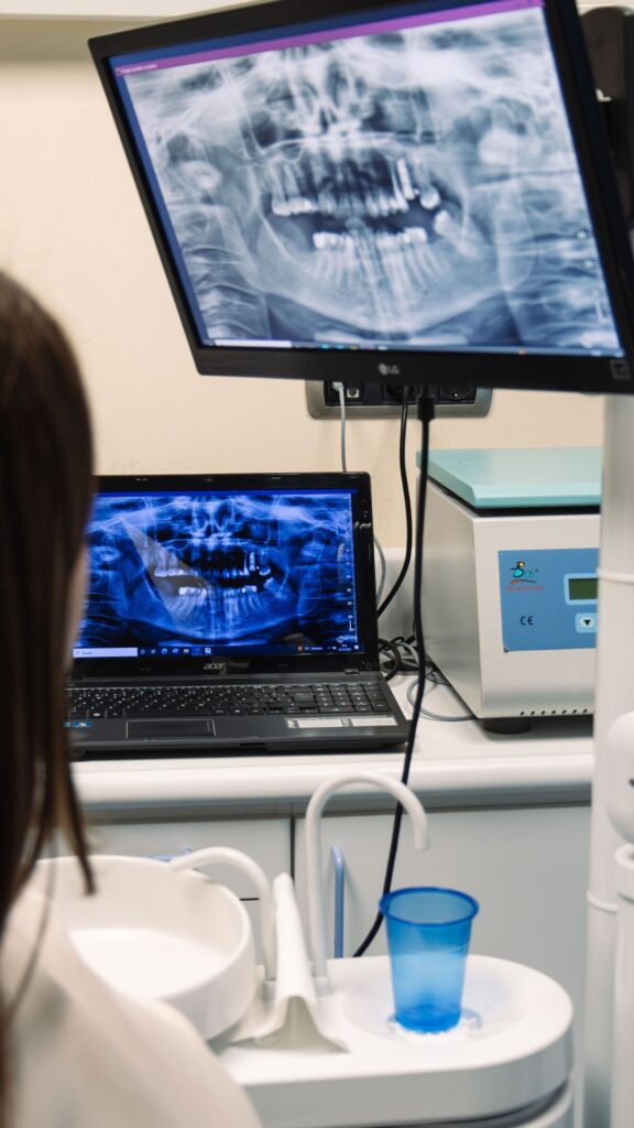 implantes dentales en León