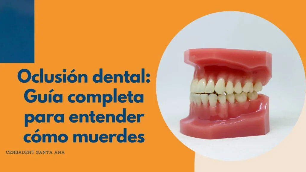 oclusión dental