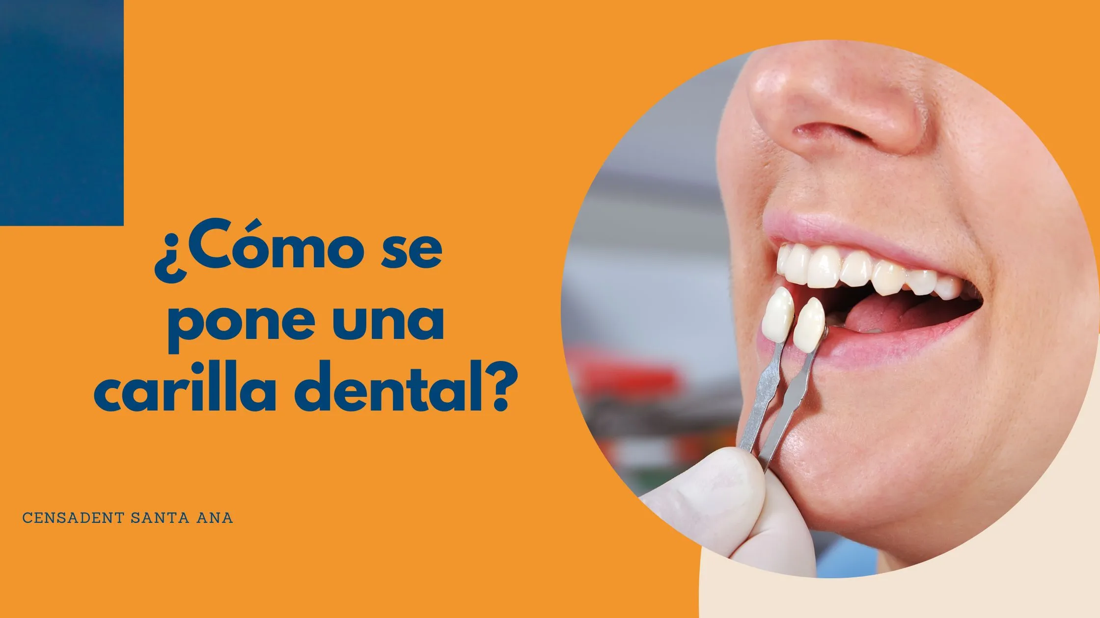 carilla dental