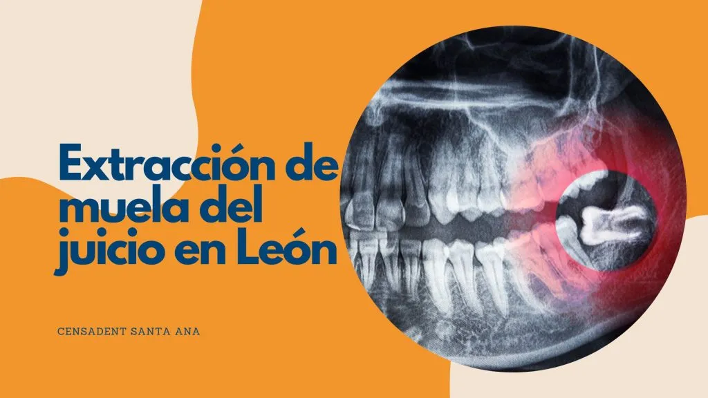 extracción de la muela del juicio